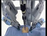 Imagen de Usp Hospital San Jaime Realiza Con Éxito Una Nefrectomía Radical Con Cirugía Robótica