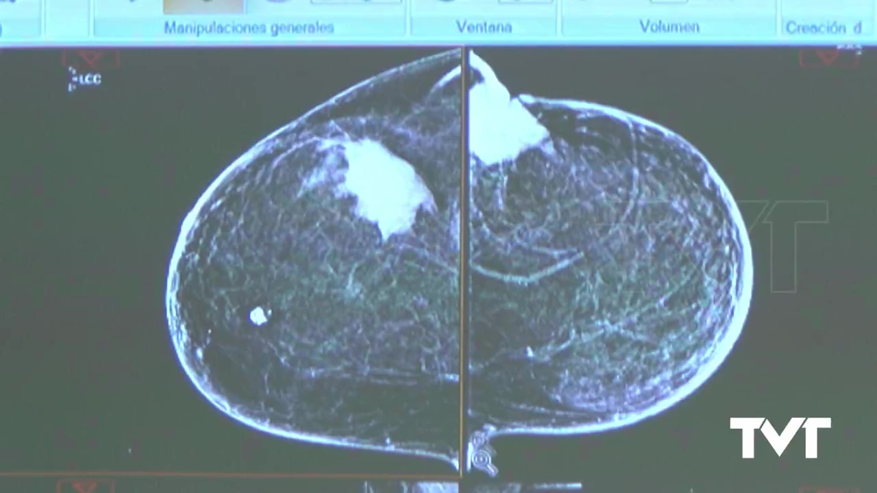 Imagen de 1.966 pacientes oncológicos han contactado para resolver dudas