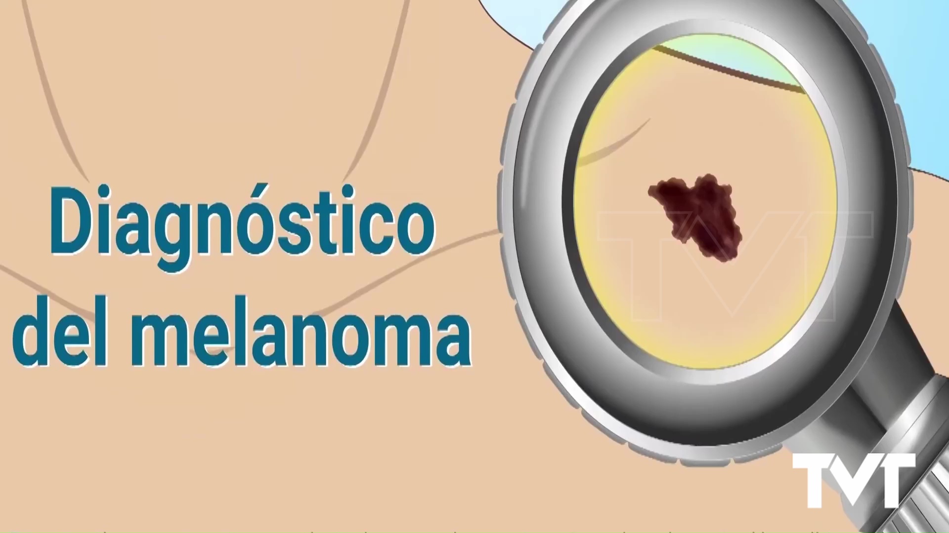 Imagen de Sanidad cifra en 668 los nuevos casos de melanoma cutáneo en un año en la Comunitat Valenciana