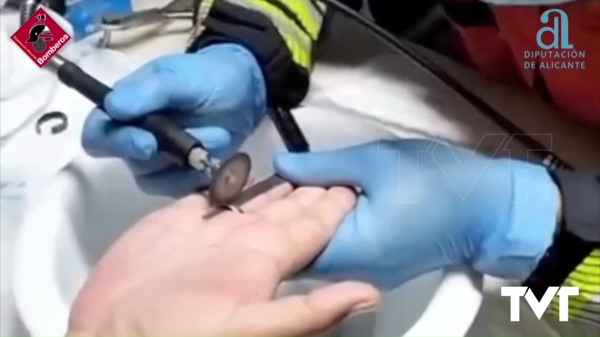 Imagen de Los bomberos de Torrevieja afinan el pulso para retirar hasta 3 anillos