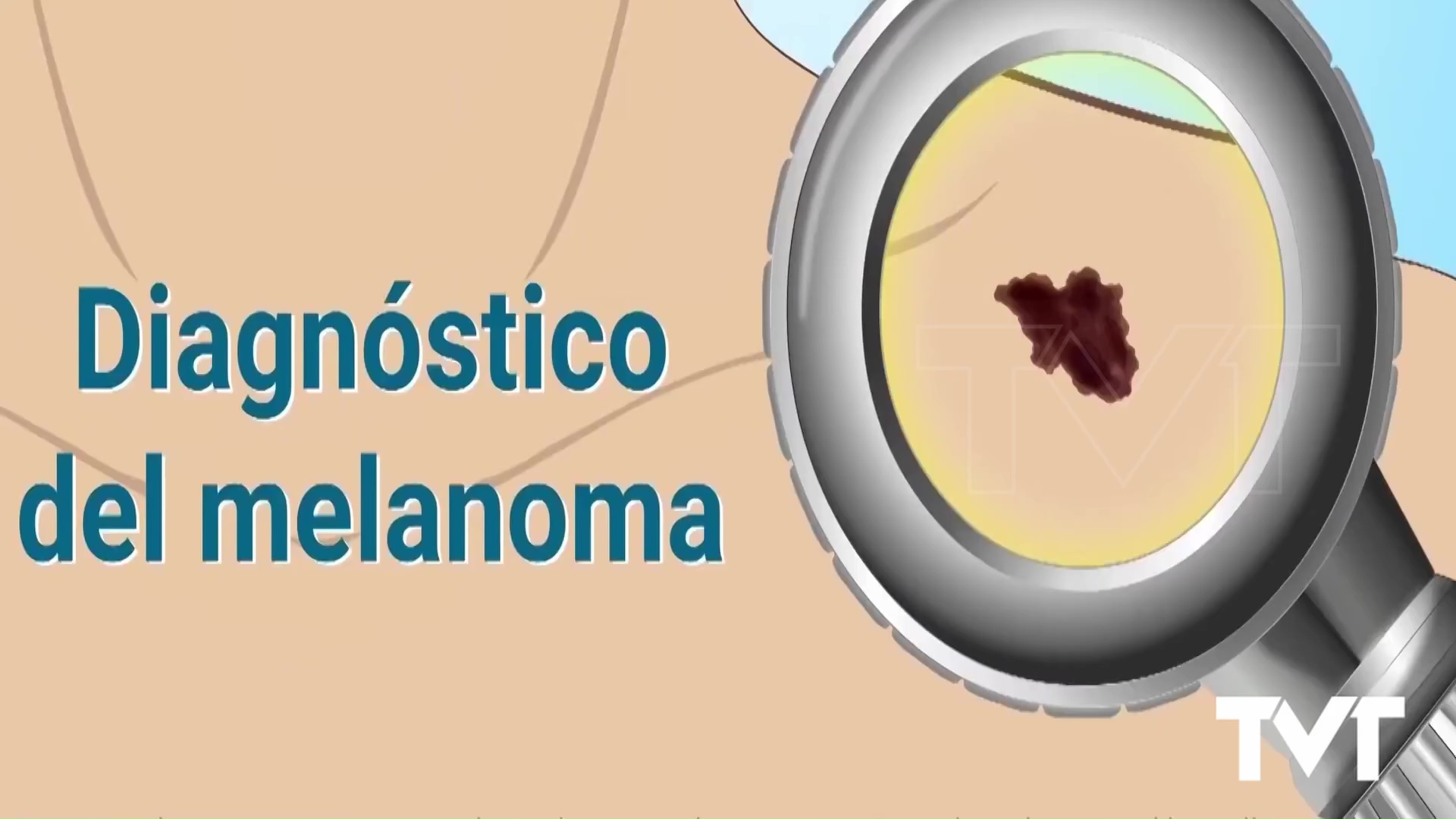 Imagen de Día Mundial del Melanoma. Es esencial conocer los riesgos y prevenirlos 