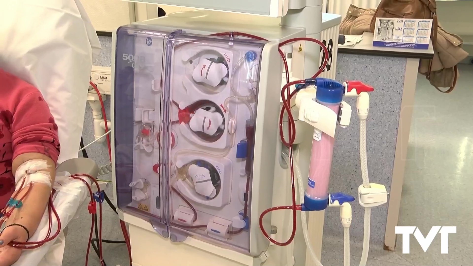 Imagen de El Hospital de Torrevieja acerca los programas de diálisis domiciliaria a un 25% de sus pacientes